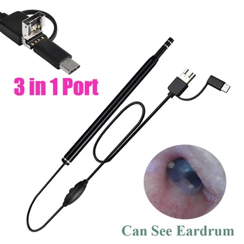 Medicinski USB-alat za čišćenje ušiju, HD Vizualni žlica za ušni vosak, uške coli, Отоскоп s mini-kamera, olovka za njegu ušiju, Endoskop za čišćenje ušiju