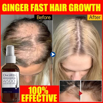 Sprej s эссенцией za rast kose s đumbirom, Efikasno ulje za oporavak ćelavosti, Sredstvo protiv opadanja kose, Njegu suhe Oštećene kože glave, Brade i rast kose